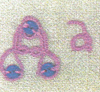 no scan available